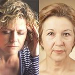 menopausia